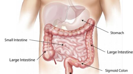 Come funziona la digestione dopo un intervento di chirurgia bariatrica?